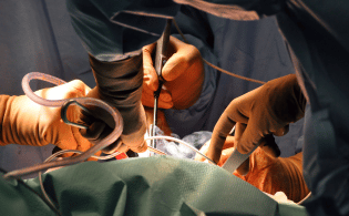 Medical Malpractice during surgery