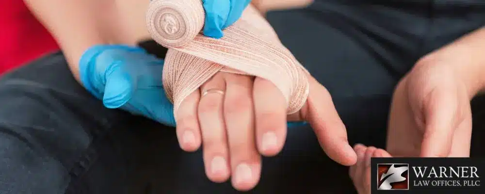 Can You Sue for Burn Injuries at Work? - Warner Law Offices PLLC